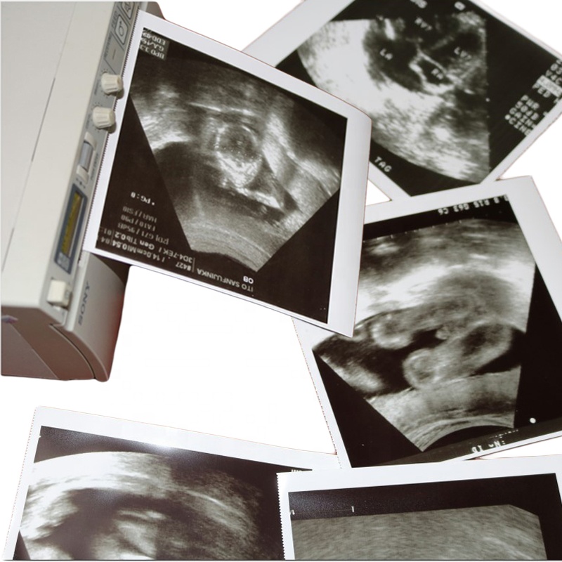 Filme branco preto de alto brilho UPP-110S/UPP-110HG 110mm * 18m rolo de papel térmico ultrassom para impressora de vídeo Sony